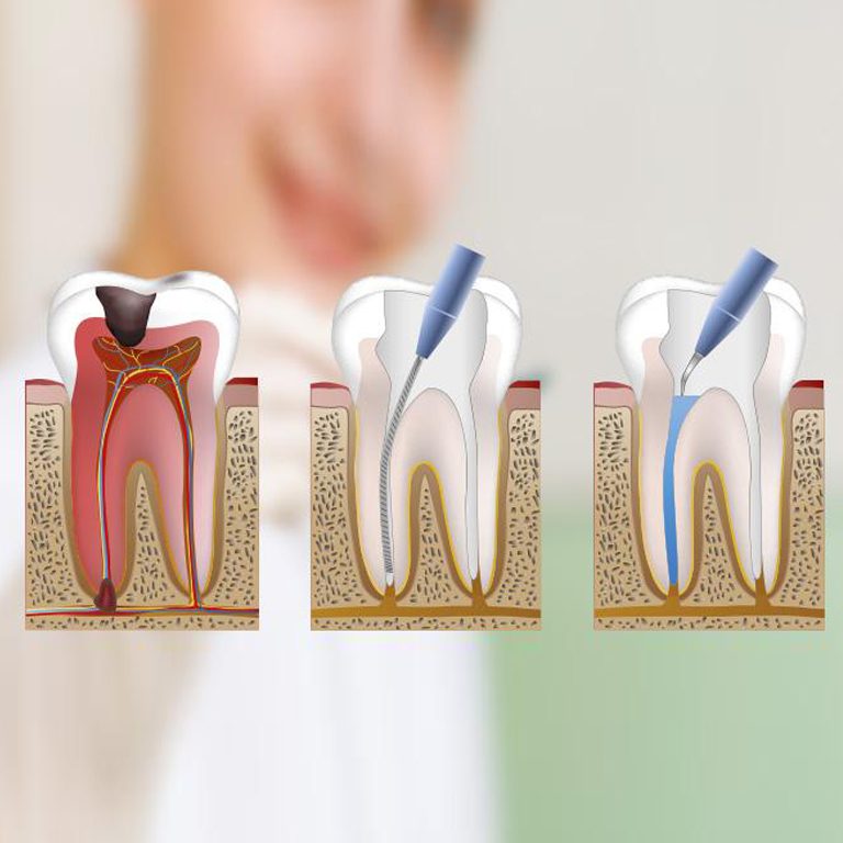 Clínica Dental #1 en Tratamientos de endodoncia en Bogotá