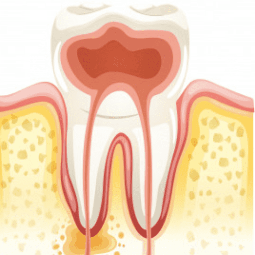 Clínica Dental #1 en Tratamientos de endodoncia en Bogotá