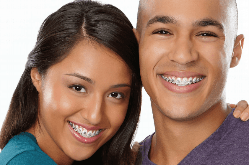 brackets autoligado metalico