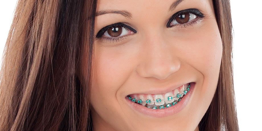 ortodoncia y brackets dentales en Bogota